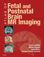 Cover for Atlas of Fetal and Postnatal Brain MR