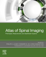 Cover for Atlas of Spinal Imaging