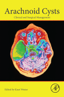 Cover for Arachnoid Cysts